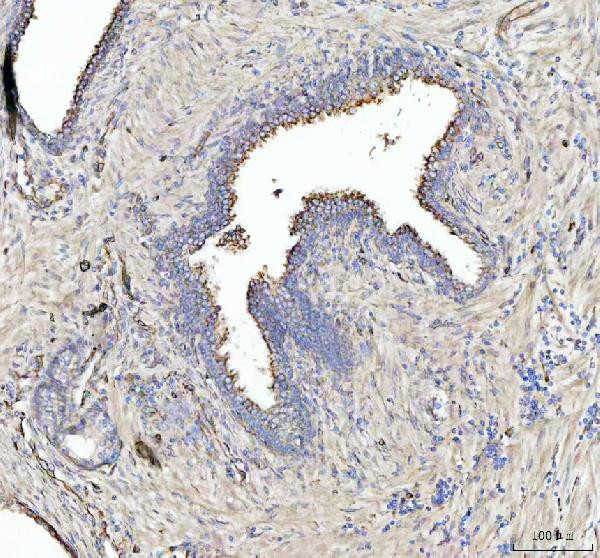Zap-70 Antibody in Immunohistochemistry (Paraffin) (IHC (P))