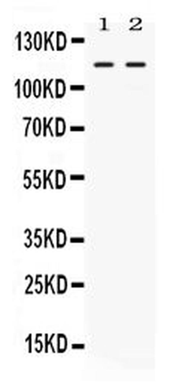 Argonaute 4 Antibody in Western Blot (WB)