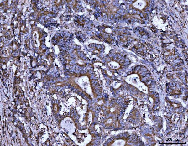 ALDH1A2 Antibody in Immunohistochemistry (Paraffin) (IHC (P))