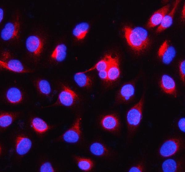 alpha Internexin Antibody in Immunocytochemistry (ICC/IF)