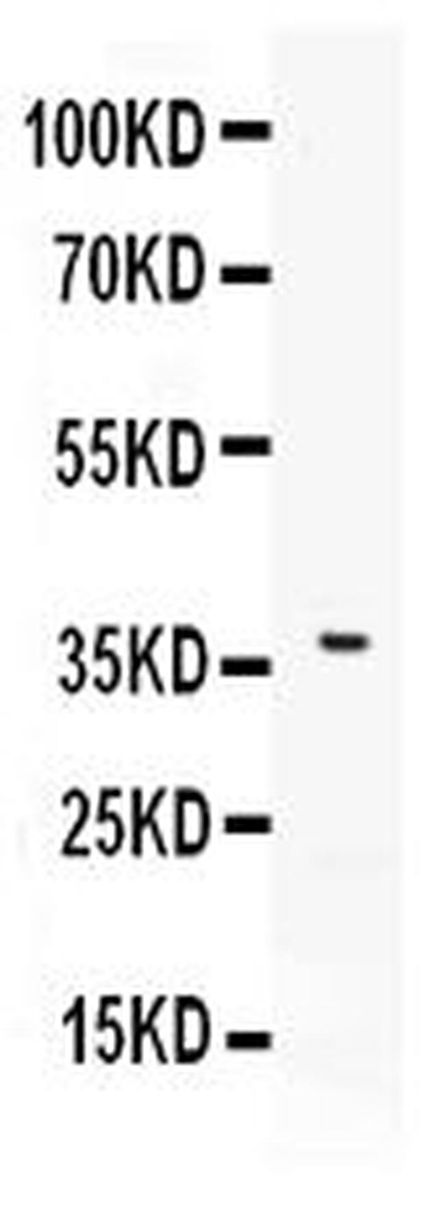 CD273 (B7-DC) Antibody in Western Blot (WB)