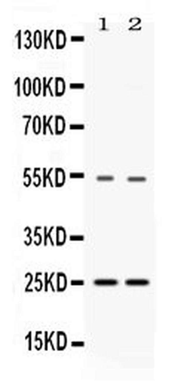 VAMP7 Antibody in Western Blot (WB)