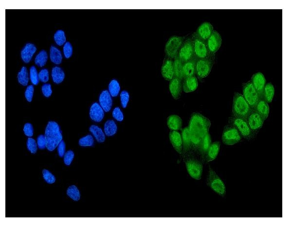 KDM5B Antibody in Immunocytochemistry (ICC/IF)