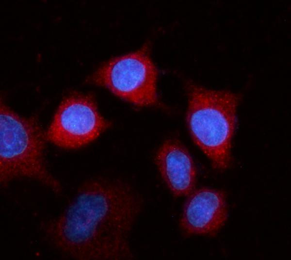 FIBB Antibody in Immunocytochemistry (ICC/IF)