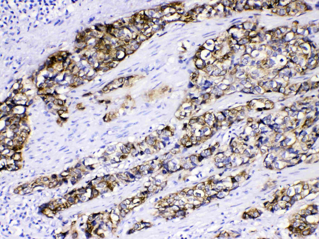 Cytokeratin 5 Antibody in Immunohistochemistry (Paraffin) (IHC (P))