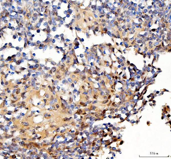 Survivin Antibody in Immunohistochemistry (Paraffin) (IHC (P))