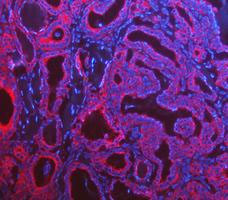 Cytokeratin 8 Antibody in Immunohistochemistry (Paraffin) (IHC (P))