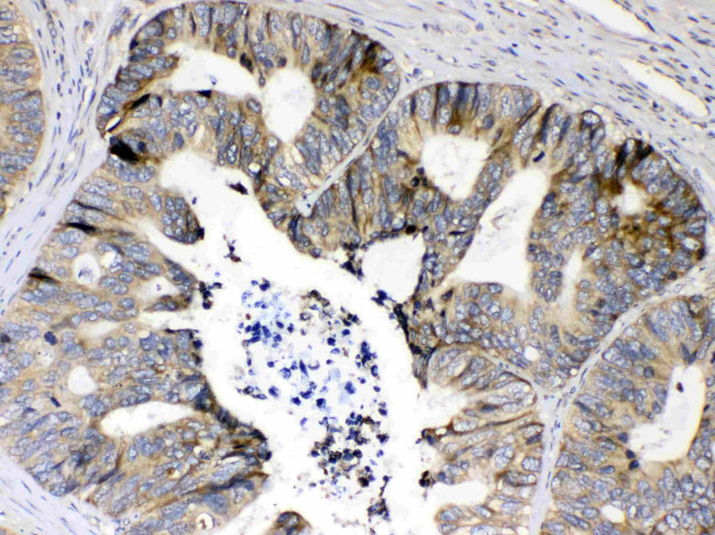 S6 Antibody in Immunohistochemistry (Paraffin) (IHC (P))