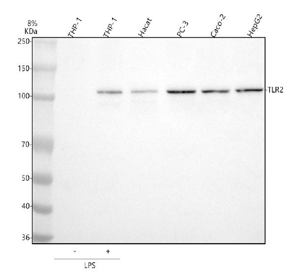 TLR2 Antibody in Western Blot (WB)