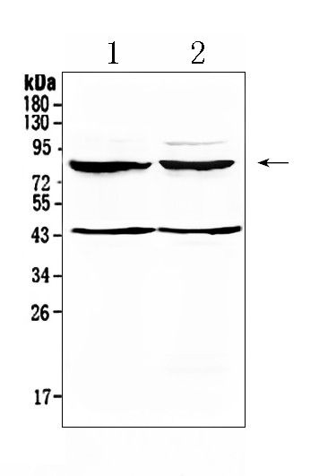 TSH Receptor Antibody in Western Blot (WB)