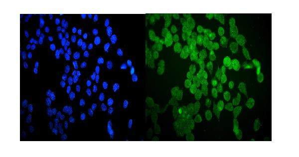HSP20 Antibody in Immunocytochemistry (ICC/IF)