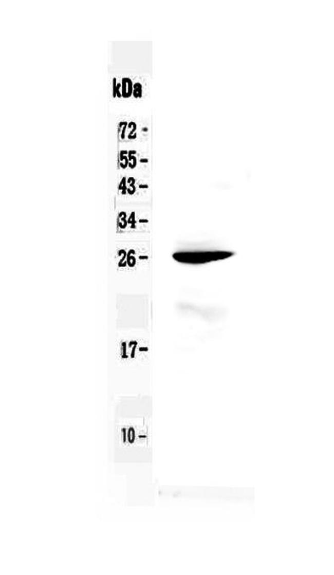 RND1 Antibody in Western Blot (WB)
