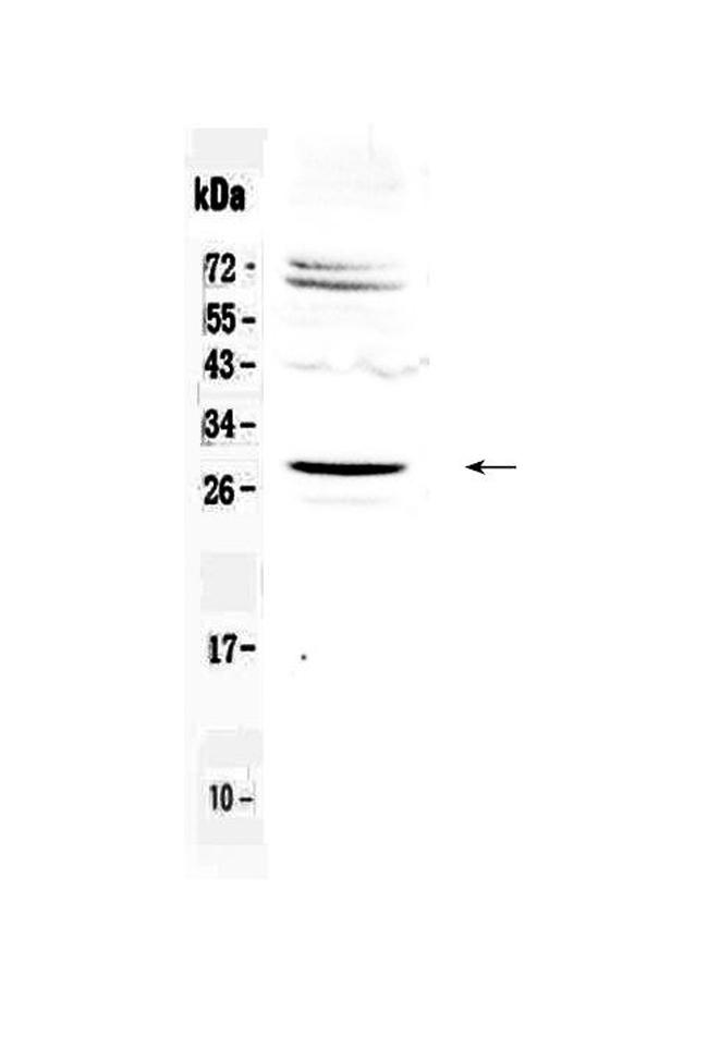 SIX6 Antibody in Western Blot (WB)