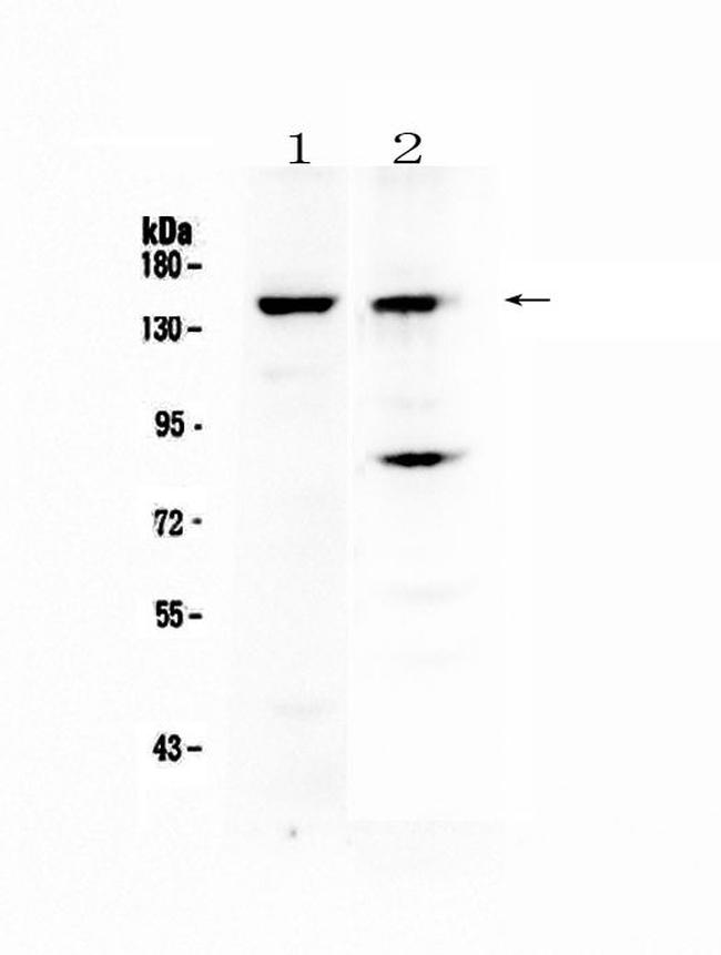 KDM2A Antibody in Western Blot (WB)