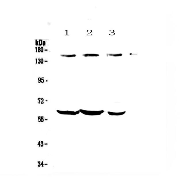 KCNH1 Antibody in Western Blot (WB)