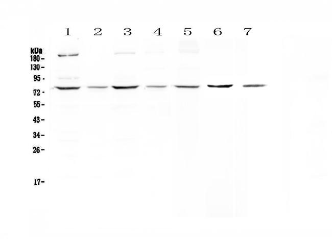 MSP Antibody in Western Blot (WB)