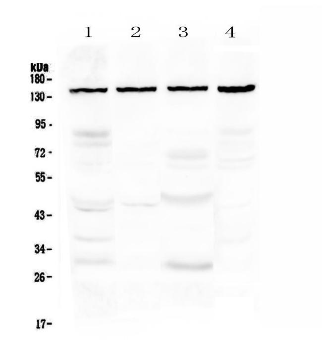 TRPC4 Antibody in Western Blot (WB)