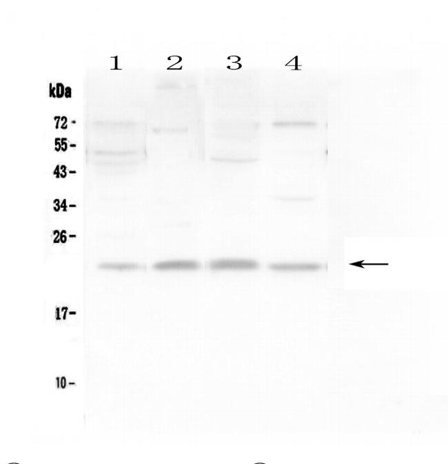 LMO2 Antibody in Western Blot (WB)