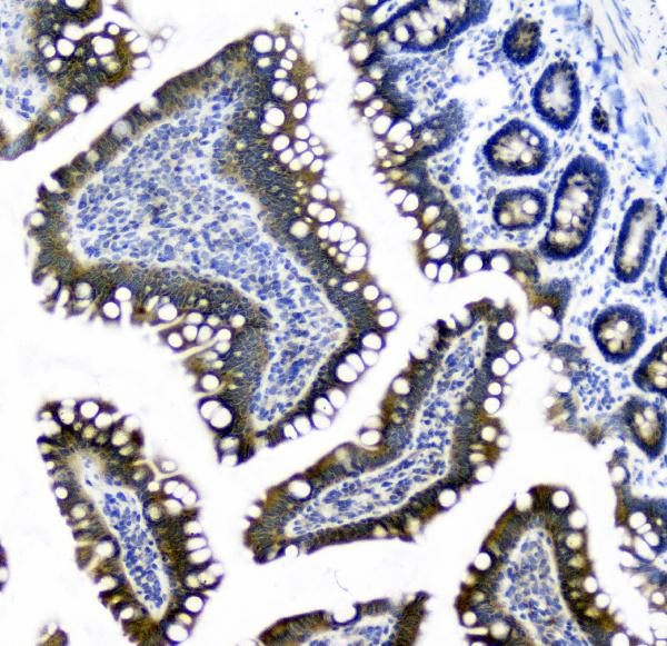 CIC Antibody in Immunohistochemistry (Paraffin) (IHC (P))