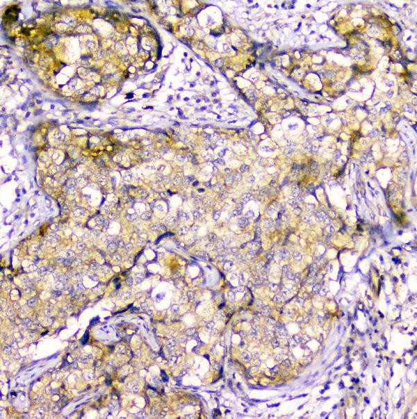 Creatine Kinase MM Antibody in Immunohistochemistry (Paraffin) (IHC (P))