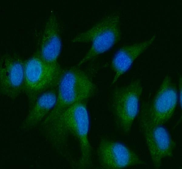 DDR2 Antibody in Immunocytochemistry (ICC/IF)