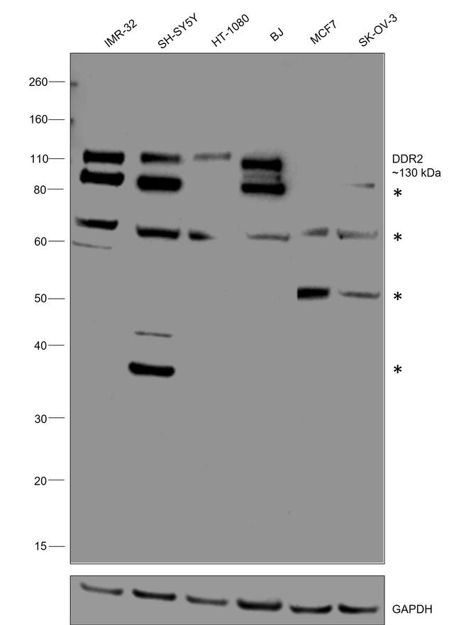 DDR2 Antibody in Western Blot (WB)