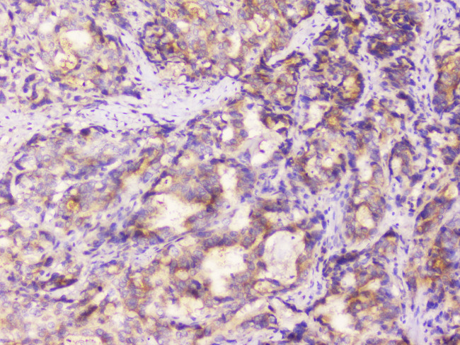 EML4 Antibody in Immunohistochemistry (Paraffin) (IHC (P))