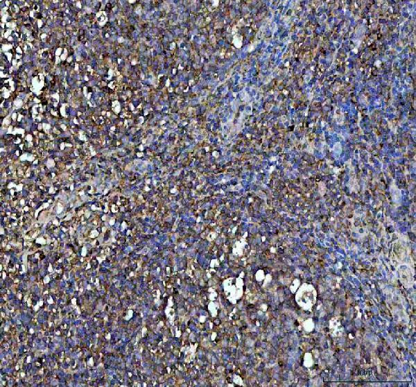 IFN gamma Antibody in Immunohistochemistry (Paraffin) (IHC (P))