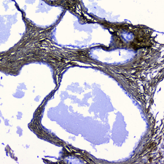 LUM Antibody in Immunohistochemistry (Paraffin) (IHC (P))