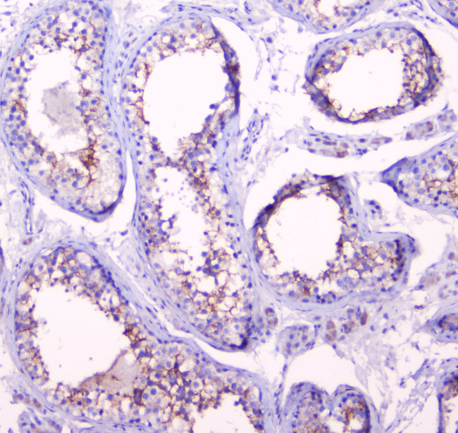 Doppel Antibody in Immunohistochemistry (Paraffin) (IHC (P))