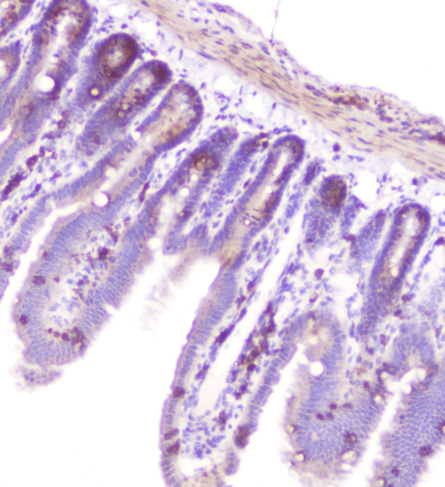 RASAL1 Antibody in Immunohistochemistry (Paraffin) (IHC (P))