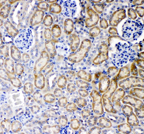 TNFR1 Antibody in Immunohistochemistry (Paraffin) (IHC (P))