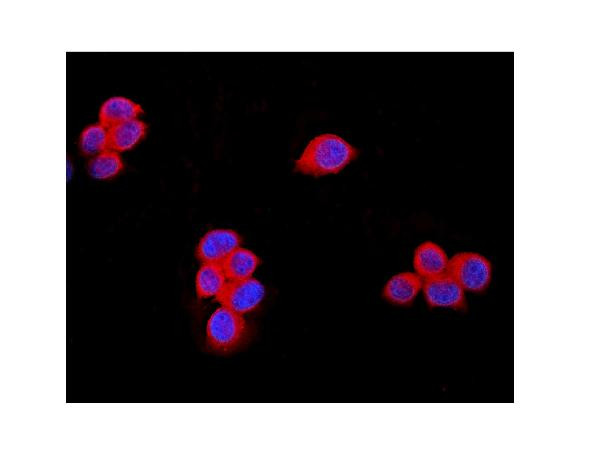 TRPM7 Antibody in Immunocytochemistry (ICC/IF)