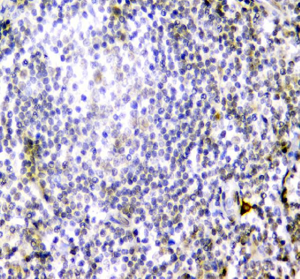 CD84 Antibody in Immunohistochemistry (Paraffin) (IHC (P))