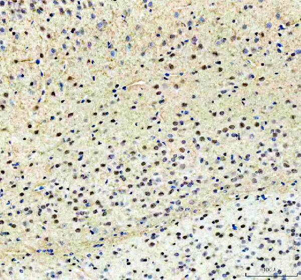 PKC beta-1 Antibody in Immunohistochemistry (Paraffin) (IHC (P))