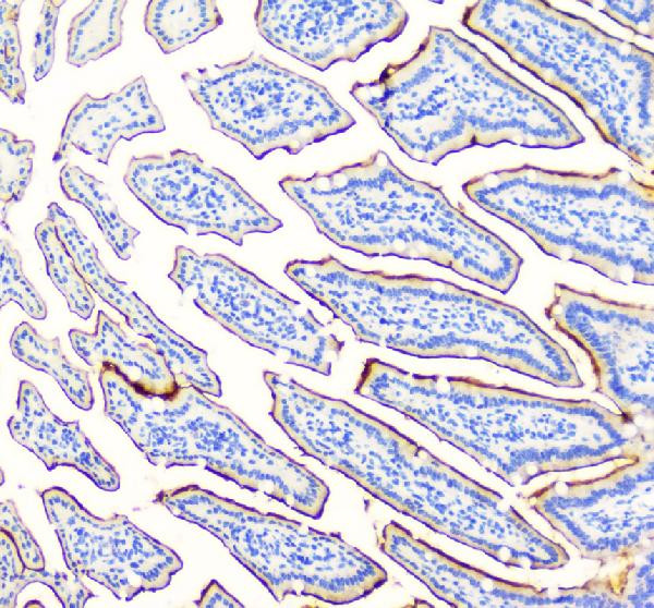 SI Antibody in Immunohistochemistry (Paraffin) (IHC (P))