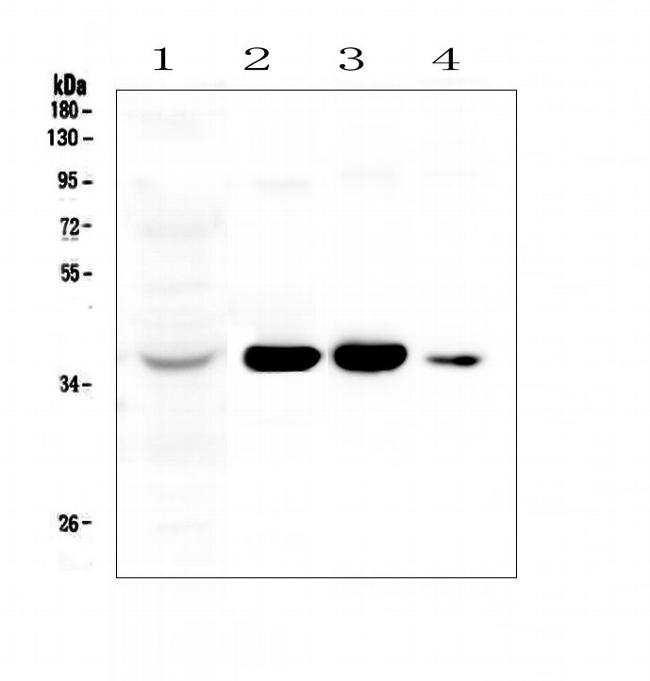 AKR1D1 Antibody in Western Blot (WB)