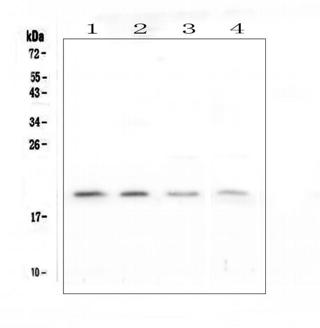 APRT Antibody in Western Blot (WB)