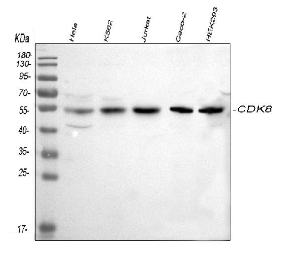 CDK8 Antibody in Western Blot (WB)