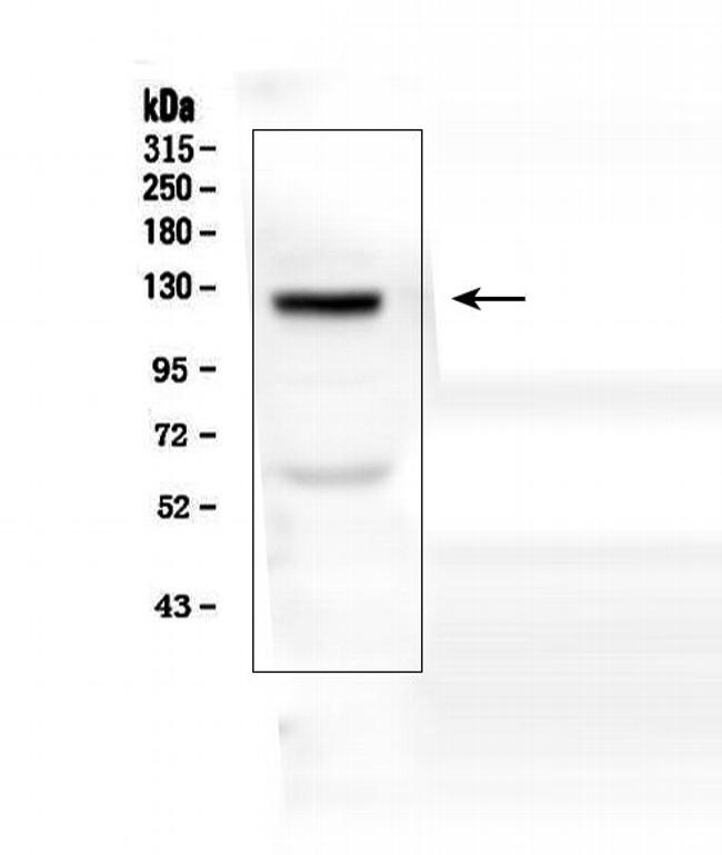 COL17A1 Antibody in Western Blot (WB)