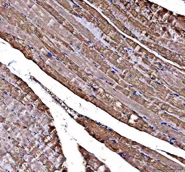 DOK7 Antibody in Immunohistochemistry (Paraffin) (IHC (P))