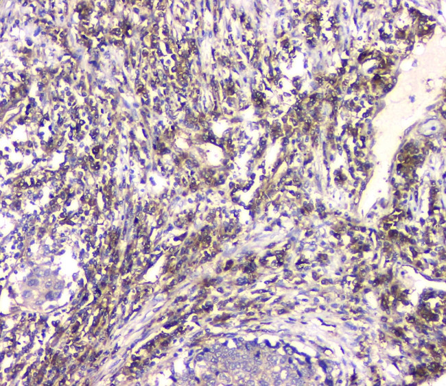 HECTD3 Antibody in Immunohistochemistry (Paraffin) (IHC (P))