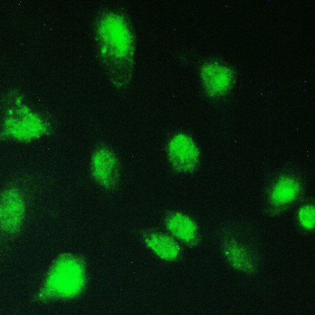 KBTBD2 Antibody in Immunocytochemistry (ICC/IF)