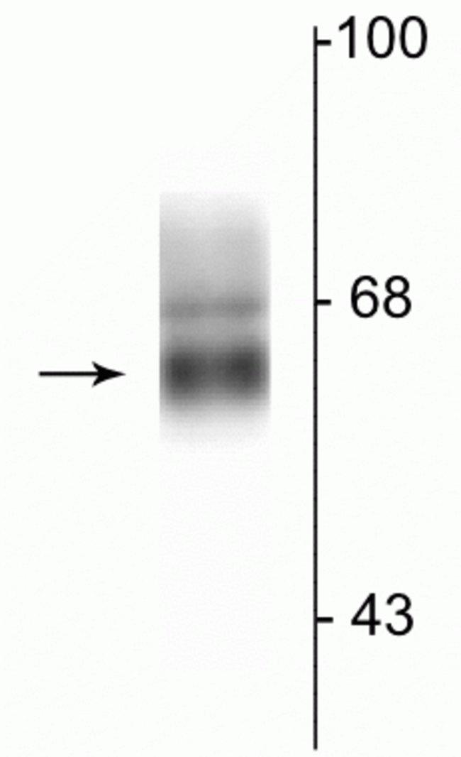 GABRA4 Antibody in Western Blot (WB)
