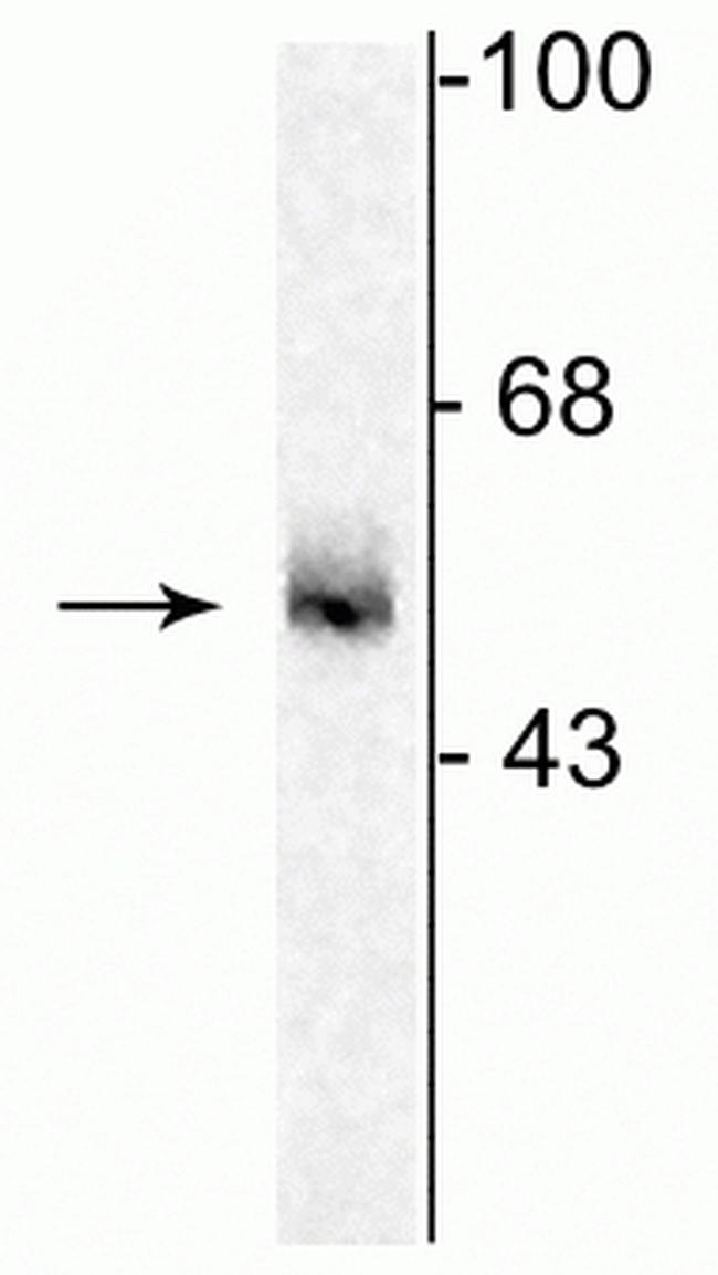 GABRA5 Antibody in Western Blot (WB)