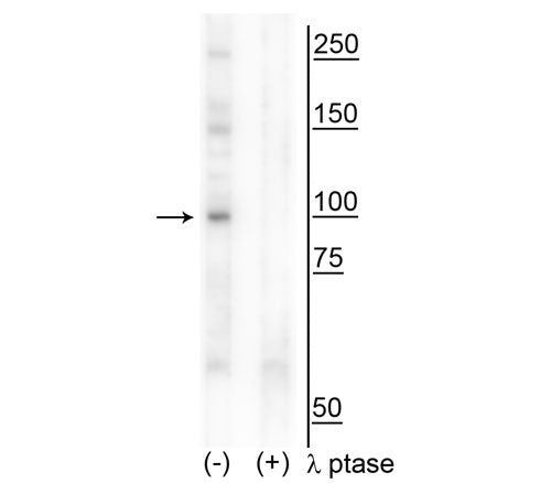 Phospho-CtIP (Thr847) Antibody in Western Blot (WB)
