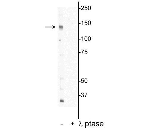 Phospho-DENND3 (Thr450) Antibody in Western Blot (WB)