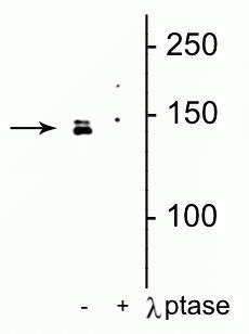Phospho-DENND3 (Ser554) Antibody in Western Blot (WB)