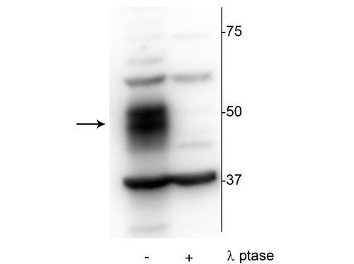 Phospho-MEF2C (Ser222) Antibody in Western Blot (WB)