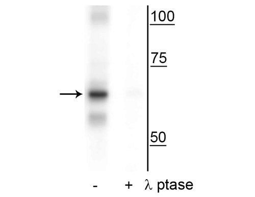 Phospho-NFkB p65 (Ser316) Antibody in Western Blot (WB)